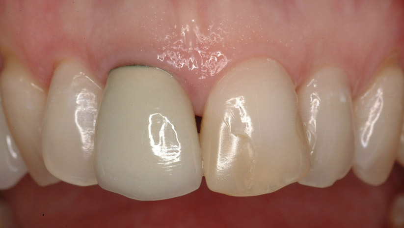 Foto 1 Protesi dentale Roma