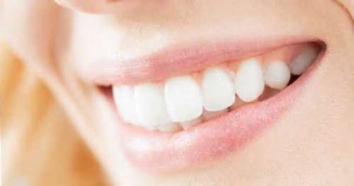 Sbiancamento dentale: sfatiamo i falsi miti